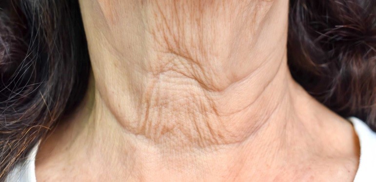 Elastic Creases