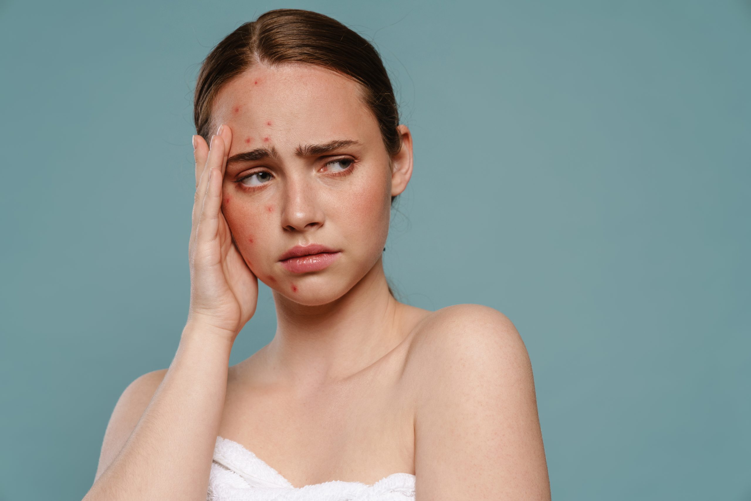 irritated skin